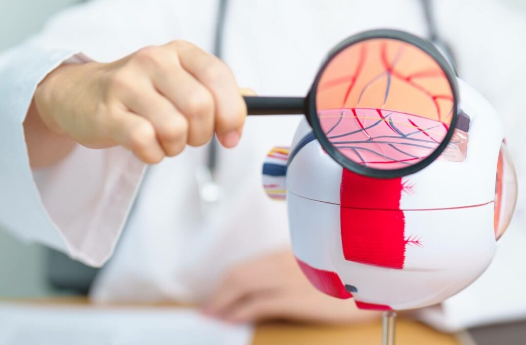Close up of a person in a white coat and stethoscope holding a magnifying glass to a model of the eye, showing blood vessels.